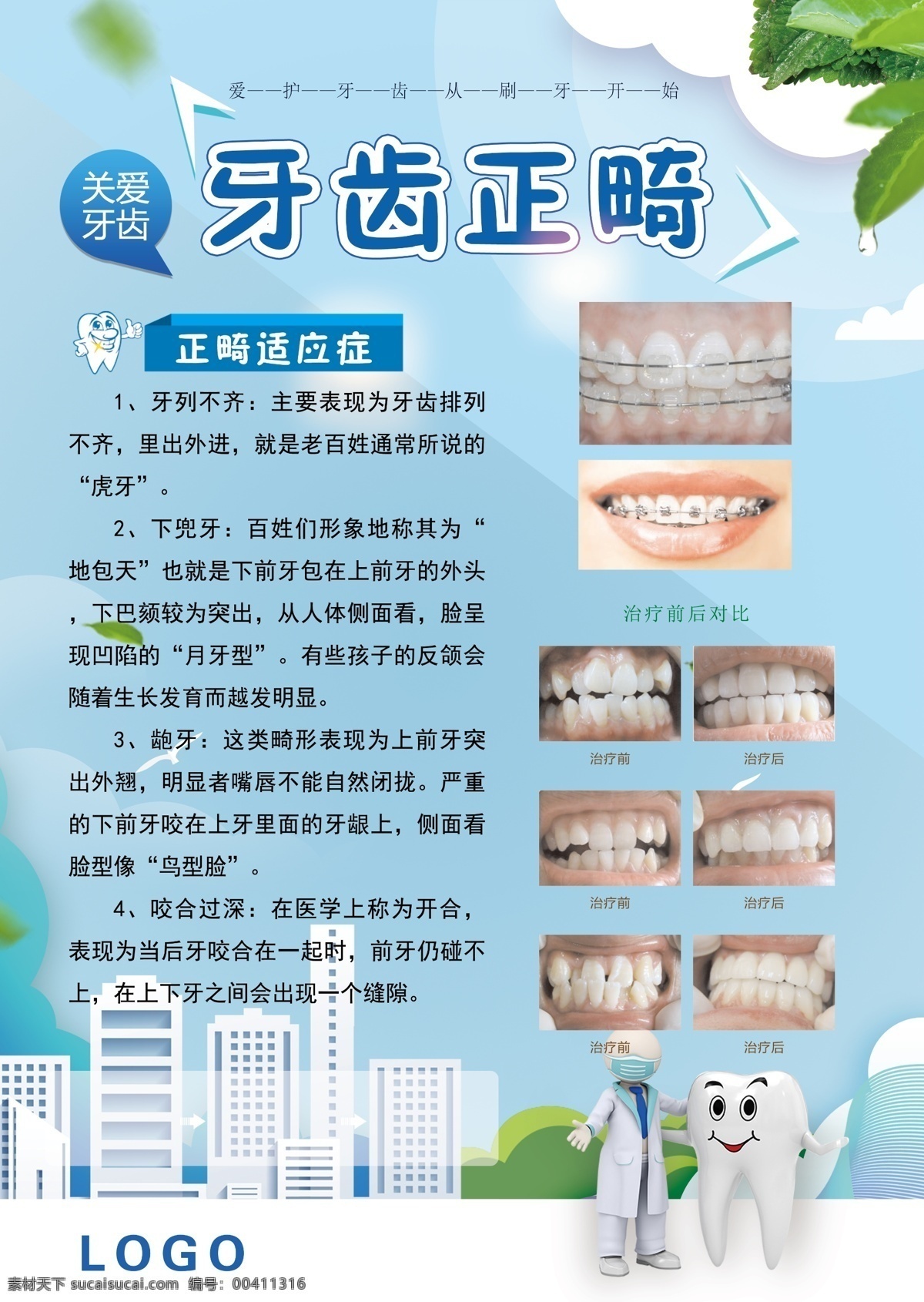 牙齿正畸 牙科展板 口腔科展板 蓝色背景 关爱牙齿 正畸适应症 正畸图片