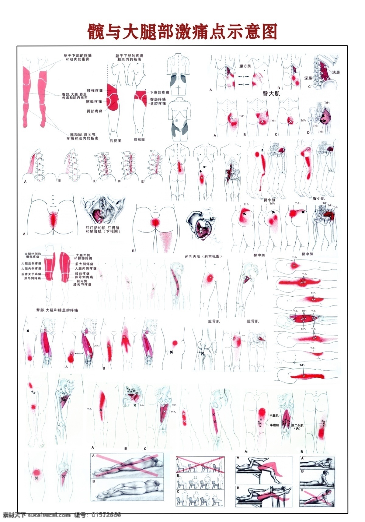 髋 大腿 部 激 痛点 示意图 医院 骨科 人体骨骼 挂图 骨骼 髋与大腿部 骨骼示意图 骨架 人物图库