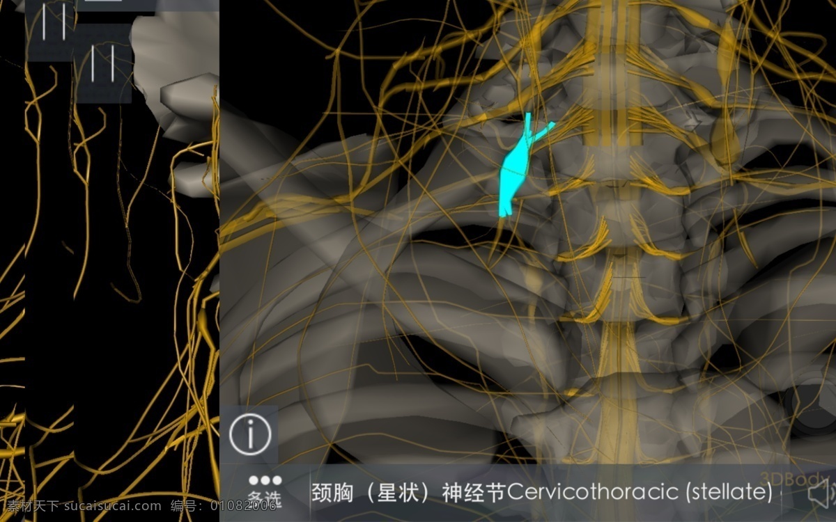 自主神经节 3d模型 背部 背面 高清图片 人体 医疗 医学 女性 女人 身体 模型 透视图 立体图 病症 症状 筋脉 脉络 脊椎 关节 疼痛 酸痛 受伤 x光透射 骨骼 人体构造