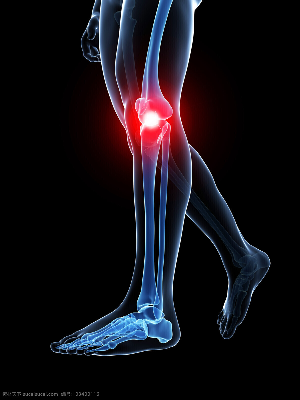 膝关节 痛 膝关节痛 人体器官 人体器官组织 人体医学 人体骨骼 医疗护理 现代科技