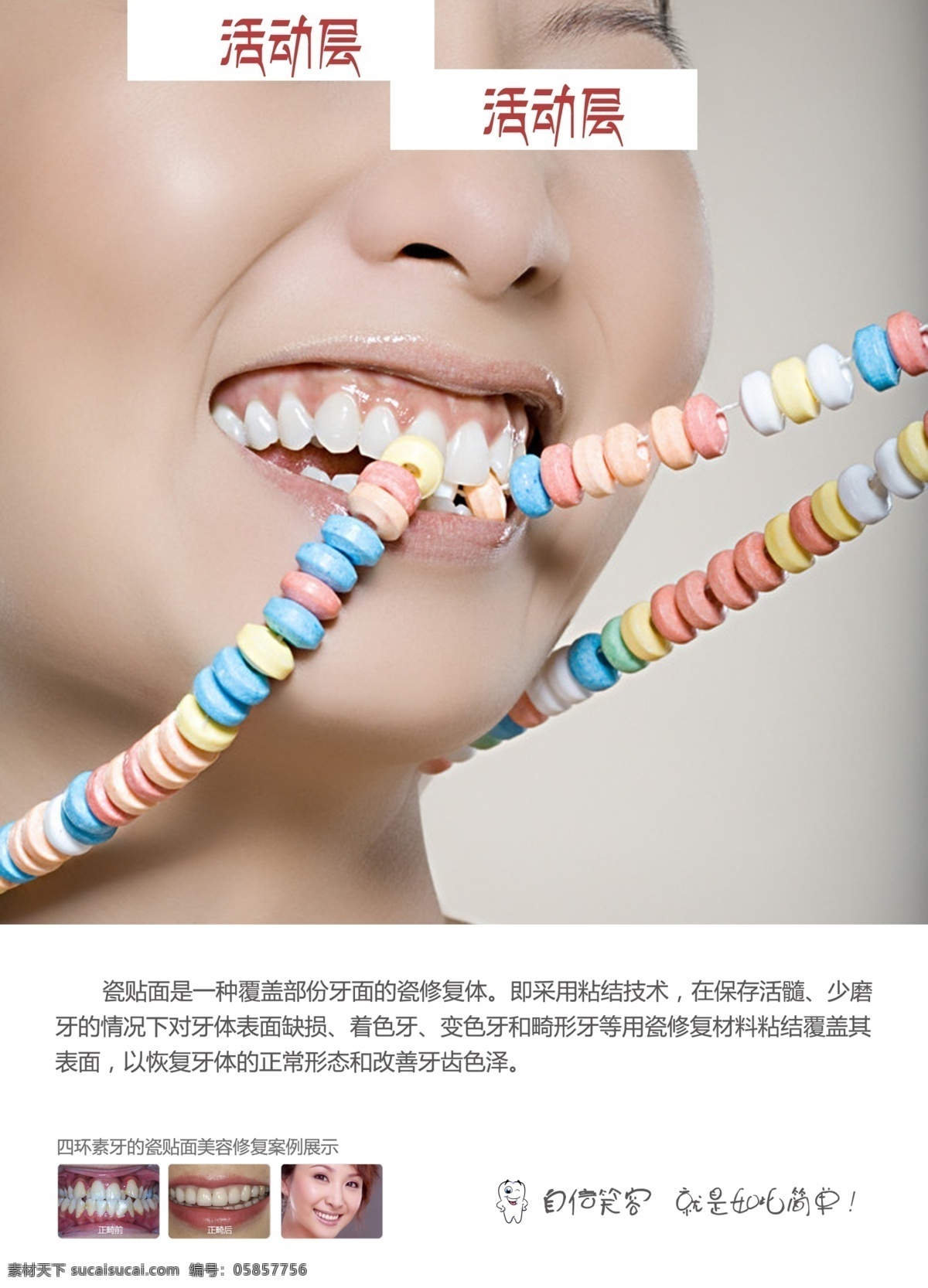 口腔科 口腔正畸 牙齿畸形 口腔美白 洁牙 美牙 牙科 牙齿 喷绘海报 其他模版 广告设计模板 源文件