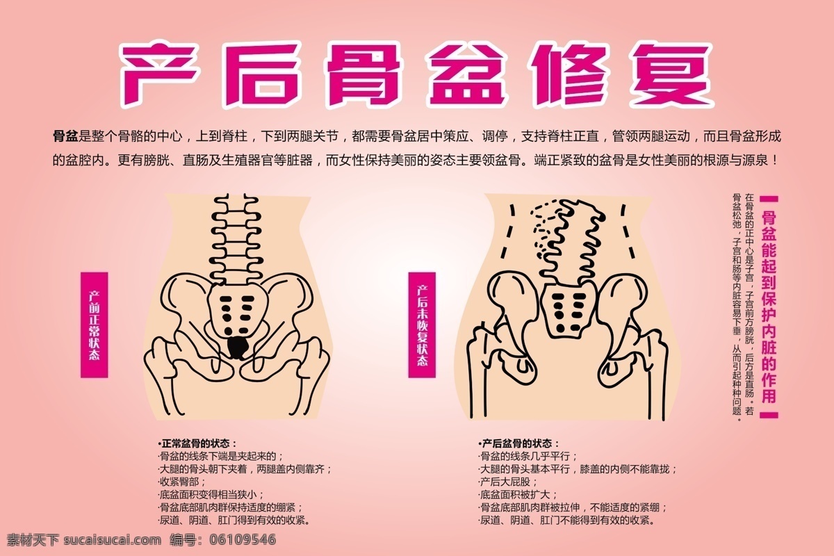 产后修复 月子 做月子 骨盆 展板 分层