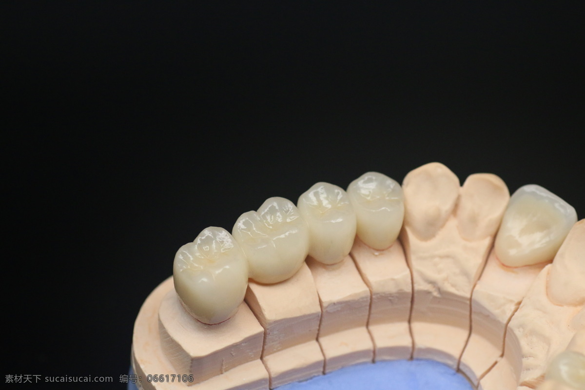 牙齿 假牙 义齿 氧化锆烤瓷牙