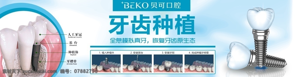 牙科 口腔诊所 种植 牙 喷绘 网站 横幅 种植牙 网站横幅