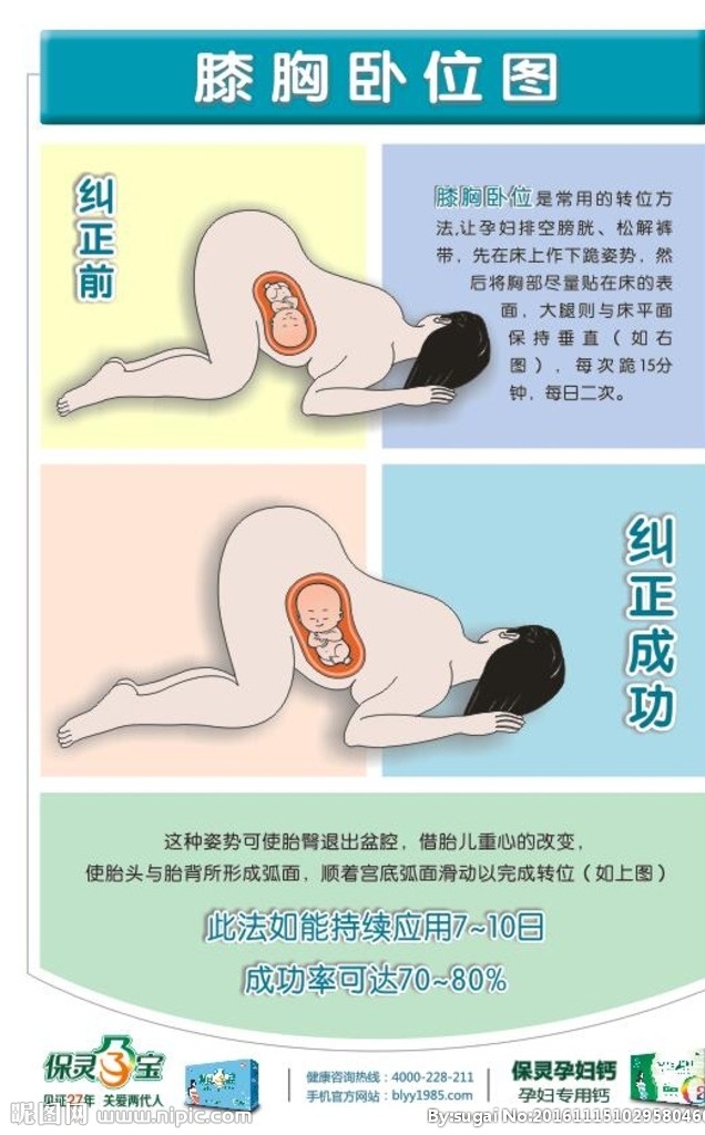 膝胸卧位图 孕妇转位方法 医院展板 保灵展板 指导方法
