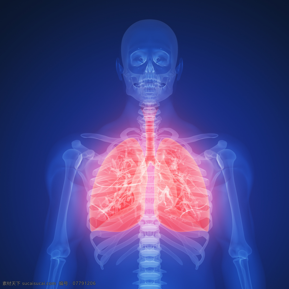 人体 肺部 x 光 医疗主题 透视图 x光 图像 医疗护理 现代科技