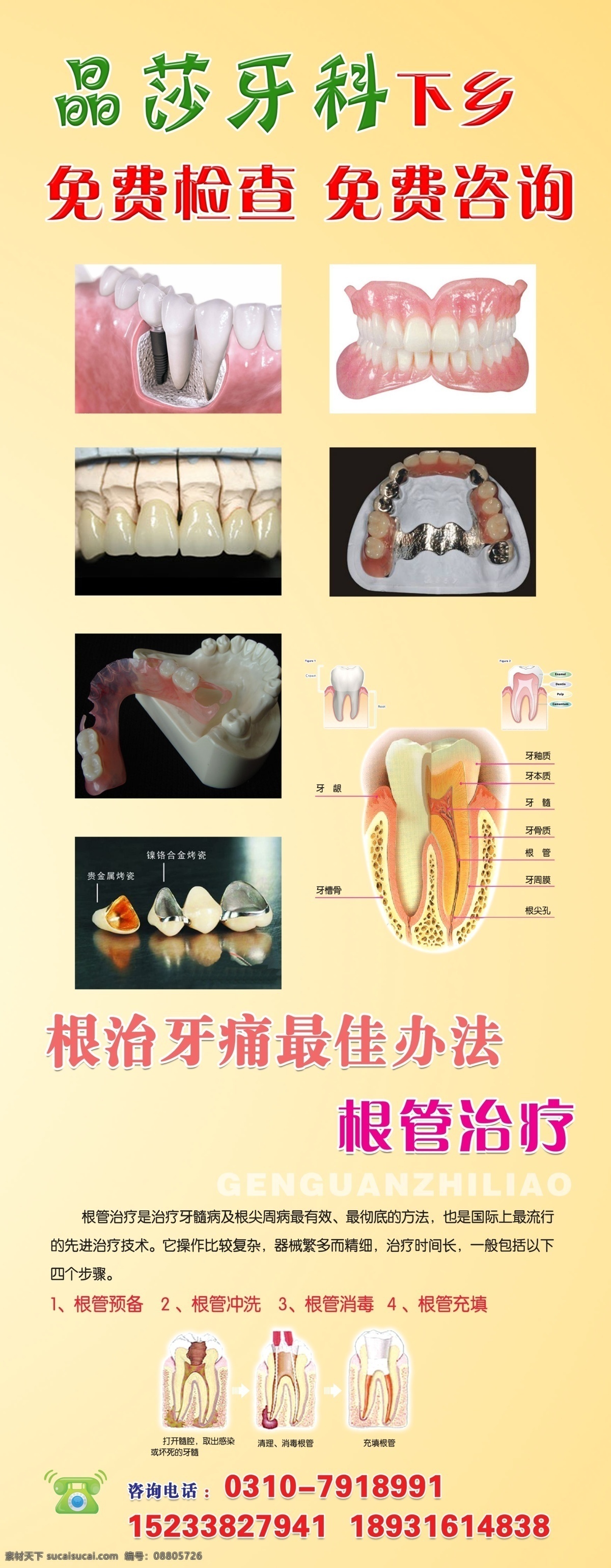 牙科图片 黄色暖光 假牙 牙结构 假牙种植 广告设计模板 源文件