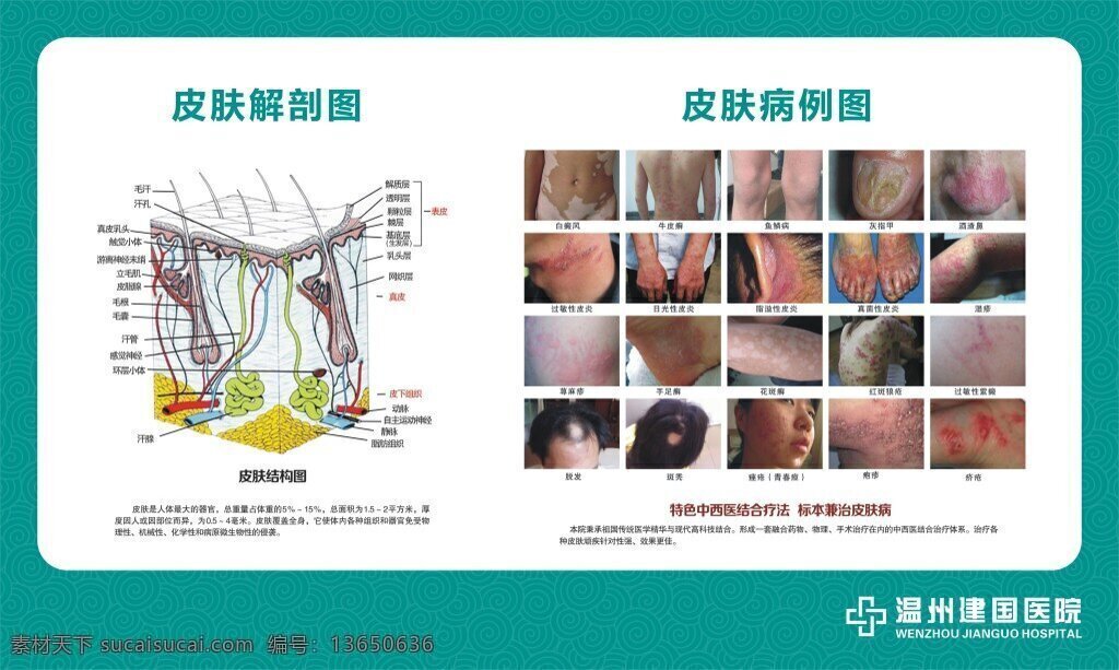 皮肤 解剖 图 展板 皮肤解剖图 解剖图 白色