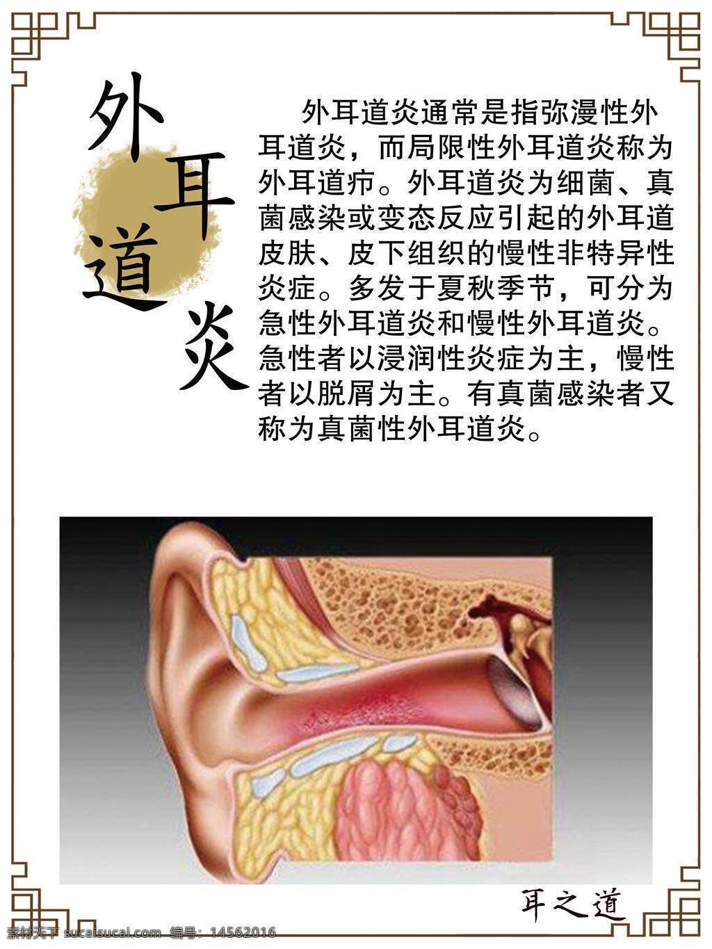 外耳道炎 什么是外耳道炎 中医养生 养生文化 古法养生 护耳